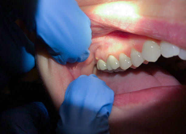 Best Pediatric Emergency Dentist in Omak, WA